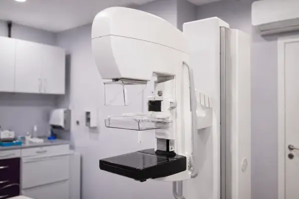 Mobilni mamografi od 26. maja u Petrovcu na Mlavi i Velikoj Plani